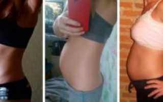 Выделения 20 неделе беременности норма