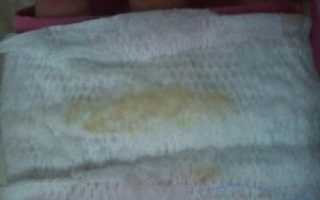 10 Недель беременности желтоватые выделения