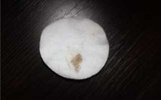 Коричневые выделения при беременности на поздних сроках беременности форум