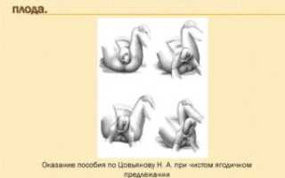 Тазовое предлежание плода в 35 недель что делать