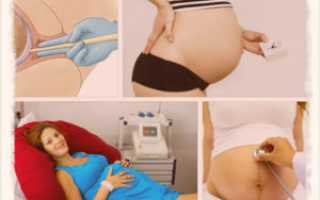 Что нужно брить перед родами