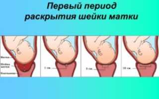 Раскрытие шейки матки на 2 пальца это сколько сантиметров