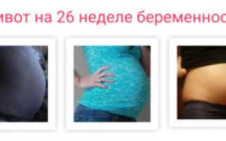 Боли Внизу Живота На 26 Неделе Беременности