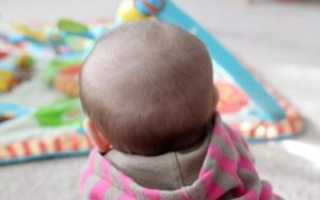 У грудничка пульсирует родничок комаровский