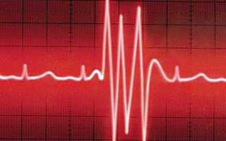 Статистика урологически заболеваний в россии