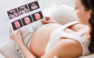 Головные Боли При Беременности В Первом Триместре