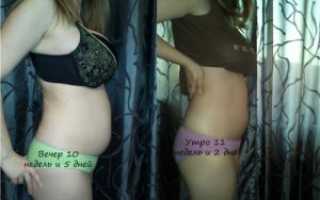 Живот раздулся как у беременной