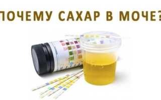 Суточный анализ мочи на сахар: как собирать, правила сбора мочи на ацентон