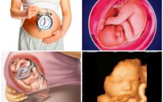 Давление на 39 неделе беременности