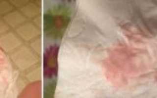 15 Неделя беременности бежевые выделения