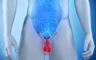 Сильная боль в яичках, паху — Медицина