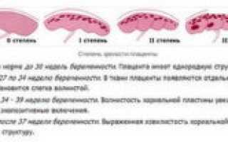 Степень зрелости плаценты 3 на 38 неделе беременности что это значит