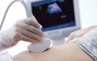 Недержание мочи после удаления матки