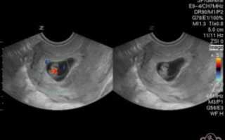 С какого срока слышно сердцебиение плода на узи