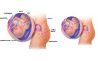 17 Недель беременности ощущения в животе форум