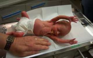 Фото Ребенка В 30 Недель Беременности Фото