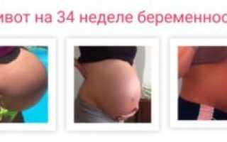 34 Неделя беременности колит низ живота