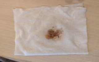 Коричневые выделения на 40 неделе беременности и тянет живот