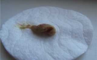 6 Неделя беременности небольшие коричневые выделения